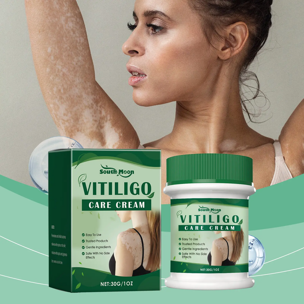 Vitiligo Treatment Cream – Natural Formula to Restore Skin Pigmentation