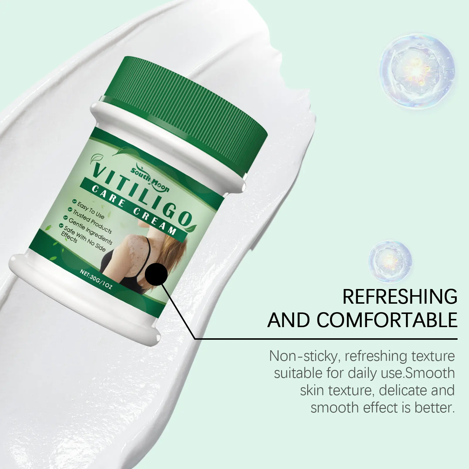 Vitiligo Treatment Cream – Natural Formula to Restore Skin Pigmentation