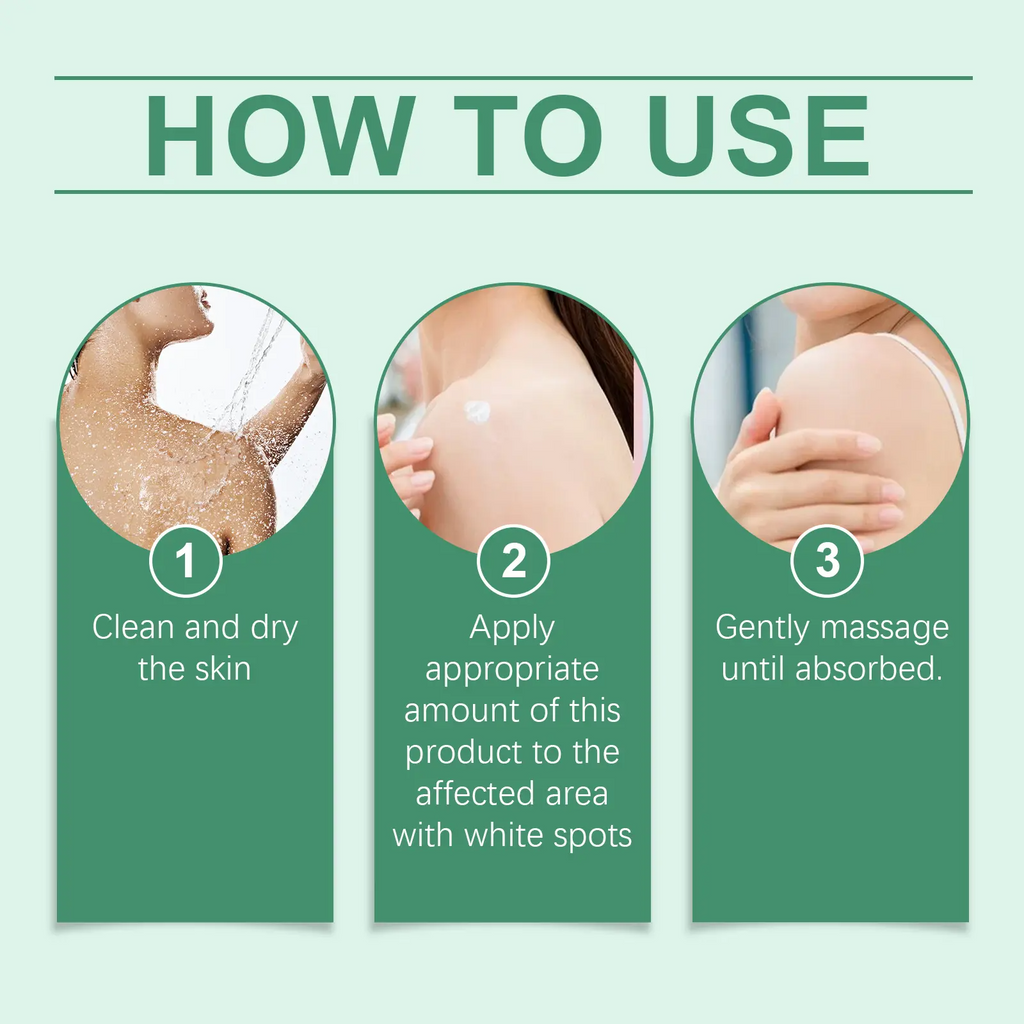 Vitiligo Treatment Cream – Natural Formula to Restore Skin Pigmentation