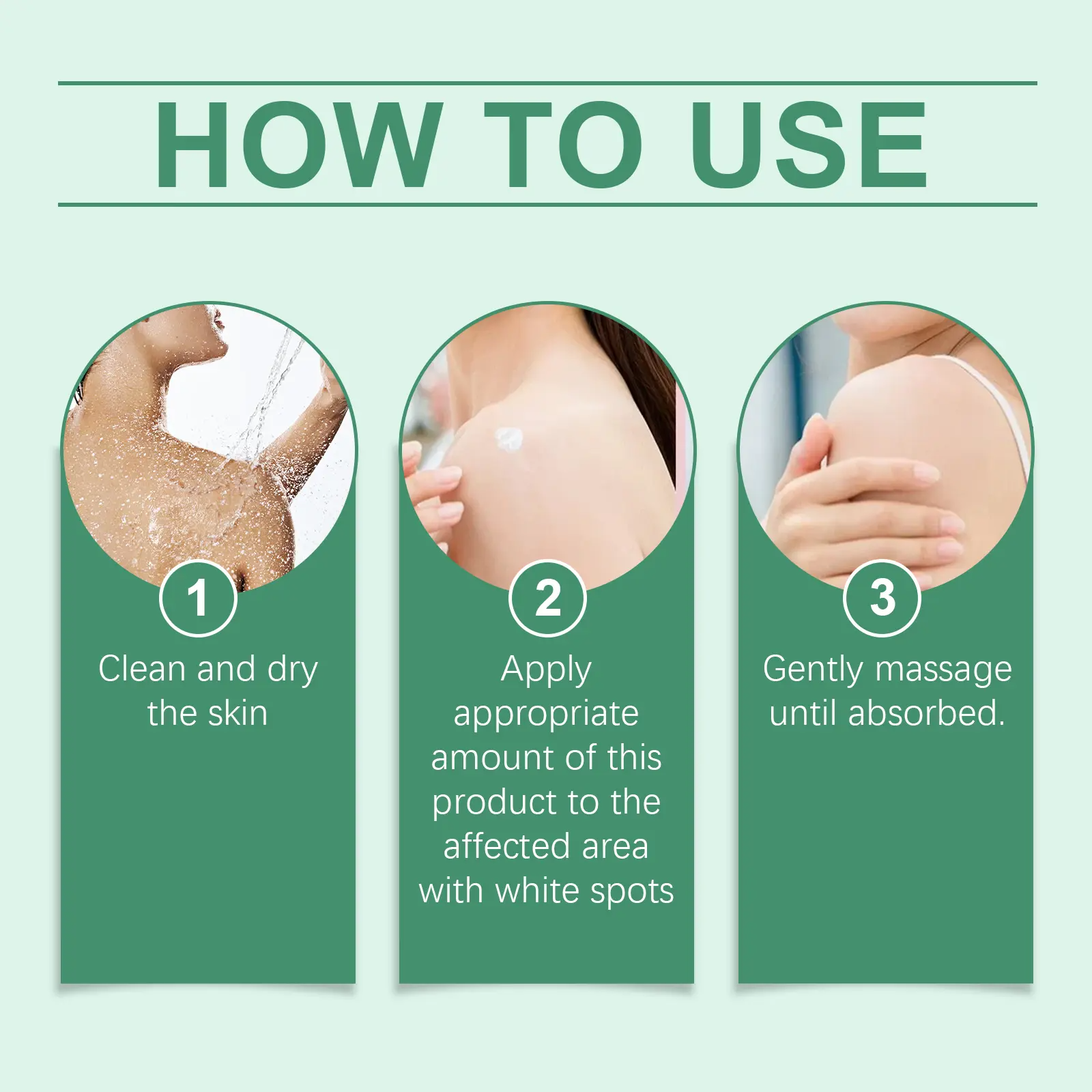 Vitiligo Treatment Cream – Natural Formula to Restore Skin Pigmentation